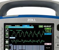 Image result for Zoll Heart Monitor