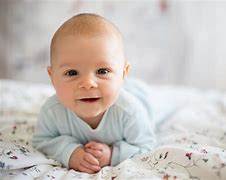 Image result for Hydranencephaly Brain Images
