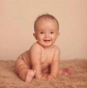 Image result for Babies with Spina Bifida