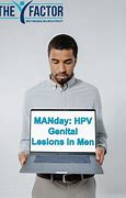 Image result for HPV Lesions in Men