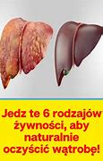Image result for co_oznacza_zdrowe_zwłoki