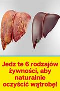 Image result for co_to_za_zwłóknienie_pozasoczewkowe