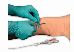 Image result for Chemotherapy PICC Line