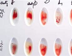 Image result for How to Test Blood Type