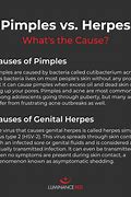 Image result for Acne in Genital Area