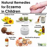 Image result for eczema treatments