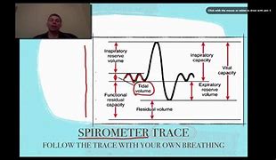 Image result for Spirometry Trace