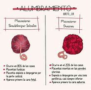 Image result for alumbramiento