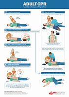 Image result for 7 Steps AED CPR