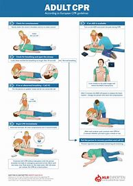 Image result for 5 Steps to CPR