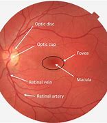 Image result for optic discs