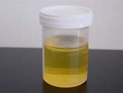 Image result for Urine Test Image Original