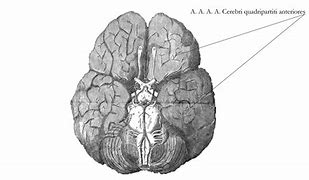 Image result for Ascended Brain