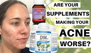 Image result for Dim for Acne