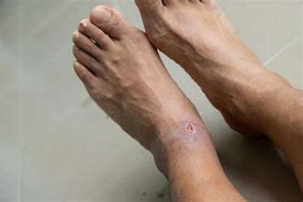 Image result for Sore Feet