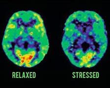 Image result for Stressed Brain vs Normal Brain