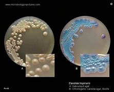 Image result for candida_tropicalis