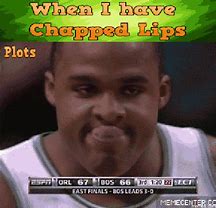 Image result for Chapped Lips Meme