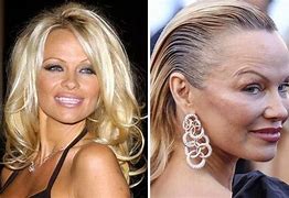 Image result for Beauty Then Vs. Now