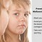 Image result for Molluscum Contagiosum Over the Counter