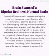 Image result for Bipolar Brain vs Normal