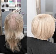 Image result for Hair Extensions for Thinning Hair