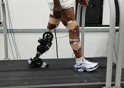 Image result for Robotic Limbs for Humans