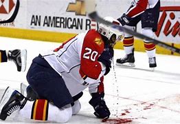 Image result for Hockey Skate Injuries