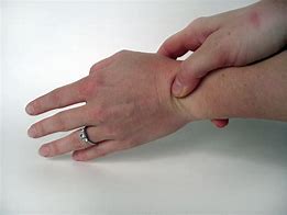 Image result for Repetitive Strain Injury