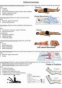 Image result for Horizontal Position After Surgery