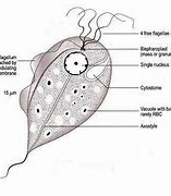 Image result for Trichomonas On Cervix