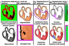 Image result for Recover CPR Heart Structure