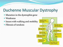 Image result for Muscular Dystrophy Mutation