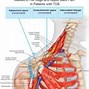 Image result for Phone Between Chin and Shoulder Cartoon