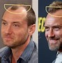 Image result for Jude Law Teeth