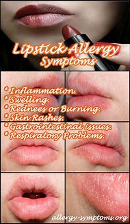 Image result for Allergic Reaction Rash On Lips