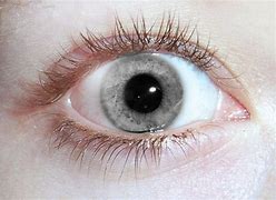 Image result for Colored Eyes