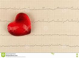 Image result for cardiogrzf�a