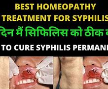 Image result for Syphilis Curable