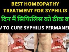 Image result for Syphilis Cure