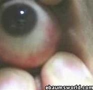 Image result for Eye Coming Out of Socket