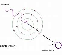 Image result for Anencephaly Radiology