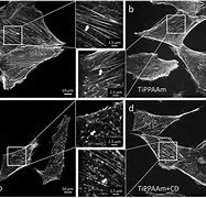 Image result for actin�grafo