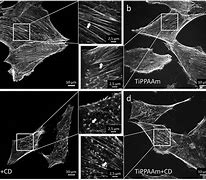 Image result for actin�metrk