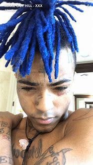 Image result for Xxxtentacion New Hair Blue