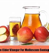 Image result for Molluscum Contagiosum Apple Cider Vinegar