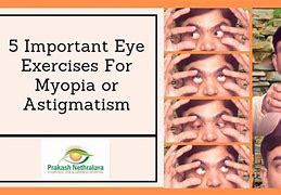 Image result for Astigmatism Cure