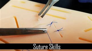 Image result for Blunt Point Needle Suture Pattern