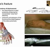 Image result for Landmarks of the Radius