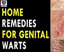 Image result for Home Genital Wart Remover